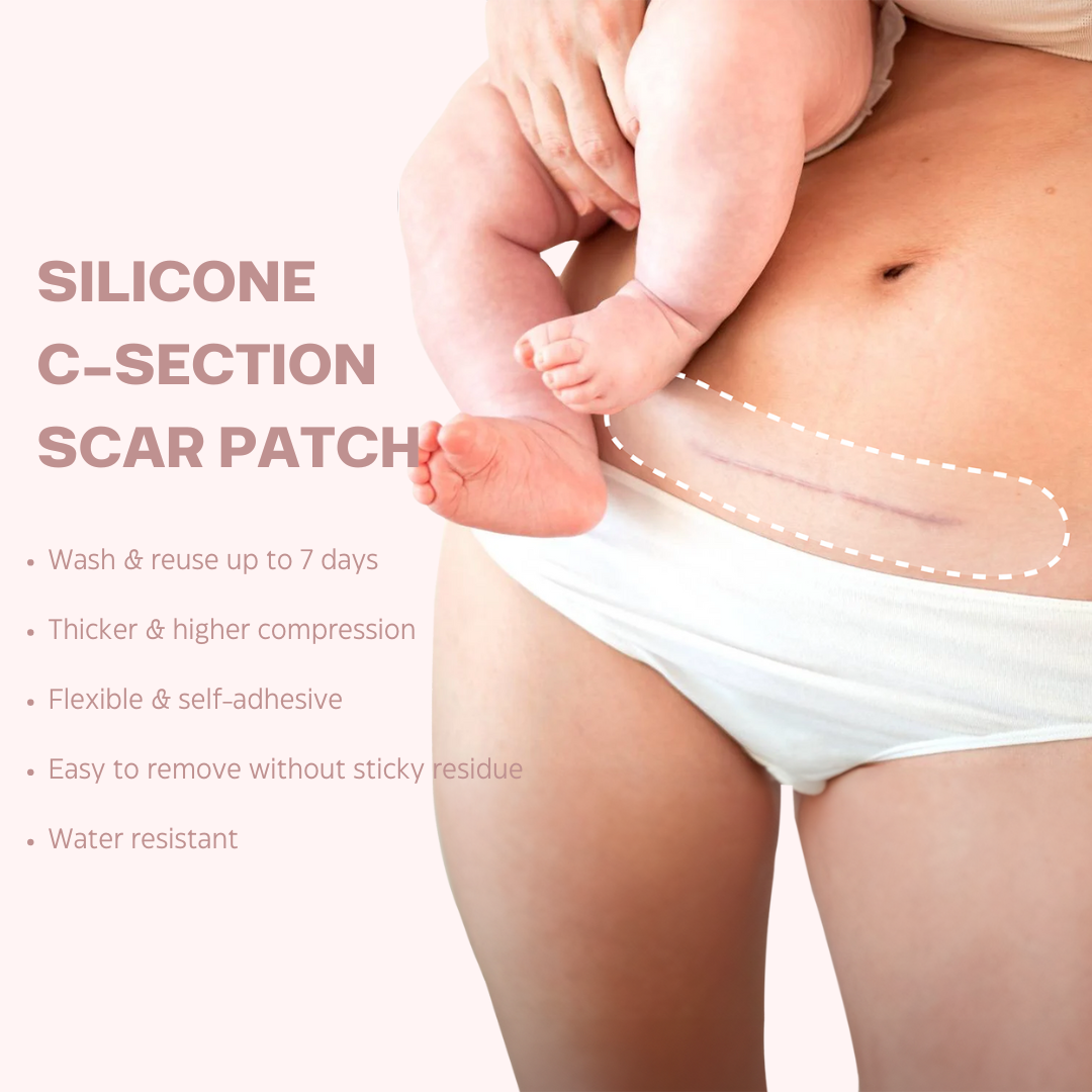 Silicone C-section Scar Patch